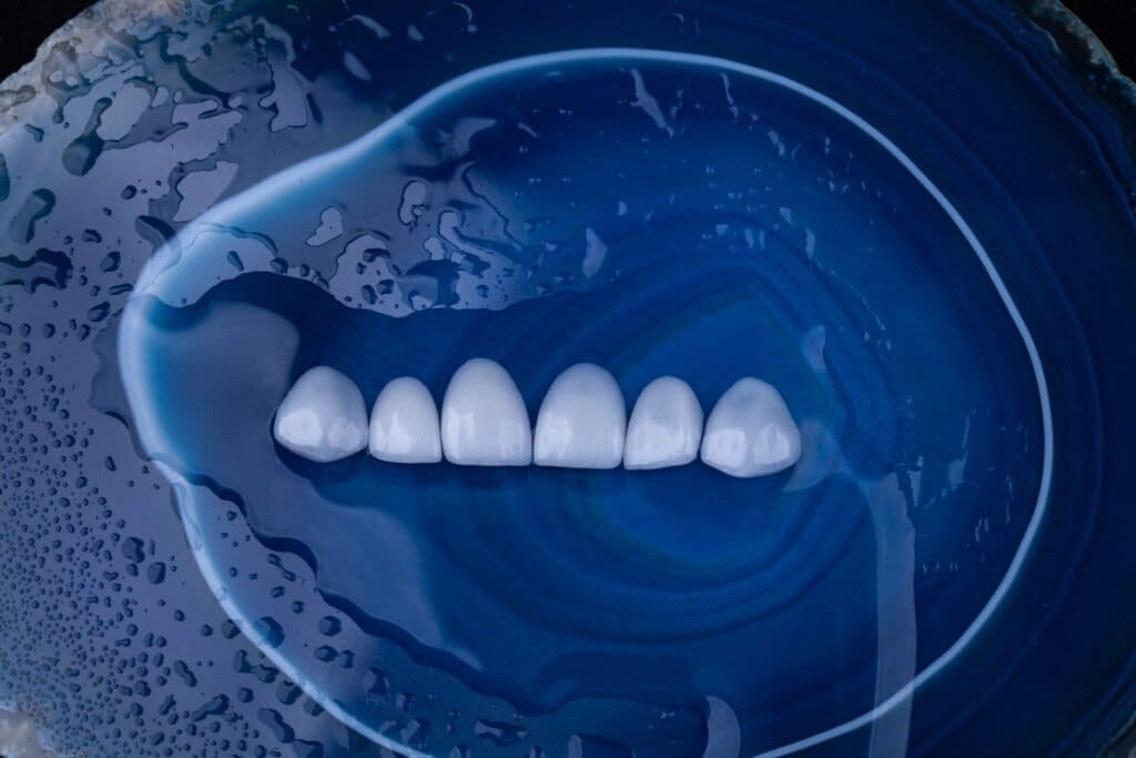 Lentes de Contato Dental geodo