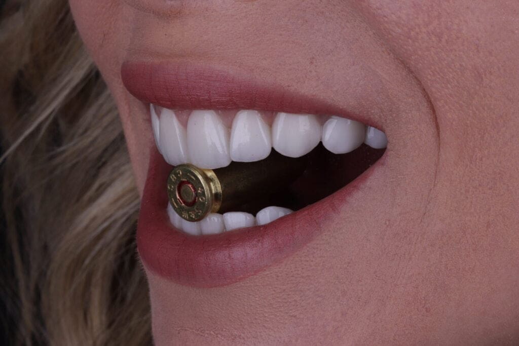 Lente de Contato Dental projetil