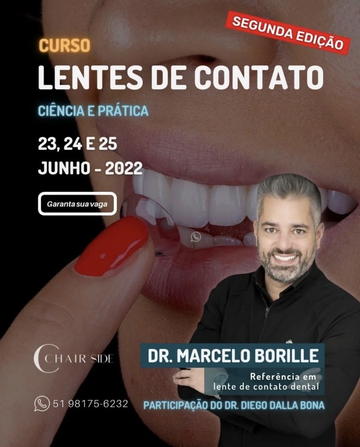 curso lente contato porto alegre